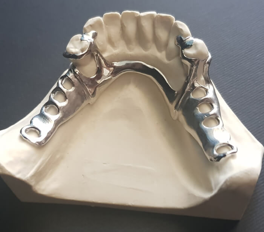 Radonić Dental Lab - Skeletirana proteza 2